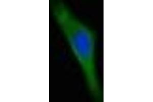 Immunofluorescent analysis of Hela cells using ABIN7173143 at dilution of 1:100 and Alexa Fluor 488-congugated AffiniPure Goat Anti-Rabbit IgG(H+L)
