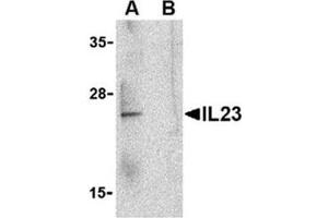 Image no. 1 for anti-Interleukin 23, alpha subunit p19 (IL23A) (C-Term) antibody (ABIN318744) (IL23A Antikörper  (C-Term))