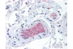 Immunohistochemistry (IHC) image for anti-Complement Factor I (CFI) antibody (ABIN4369126) (Complement Factor I Antikörper)