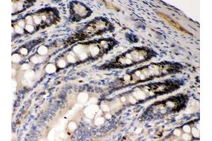 Immunohistochemistry (IHC) image for anti-Absent in Melanoma 2 (AIM2) (AA 14-215) antibody (ABIN3043780)