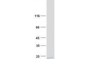 Western Blotting (WB) image for Glutathione Transferase zeta 1 (Maleylacetoacetate Isomerase) (GSTZ1) (Transcript Variant 3) protein (Myc-DYKDDDDK Tag) (ABIN2725250)