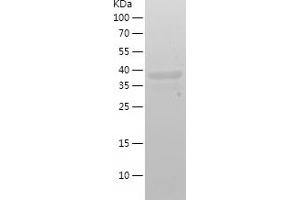 DGAT1 Protein (AA 1-90) (His-IF2DI Tag)