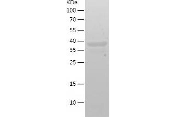 DGAT1 Protein (AA 1-90) (His-IF2DI Tag)