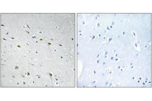 Immunohistochemistry analysis of paraffin-embedded human brain tissue, using CDC25C (Ab-48) Antibody. (CDC25C Antikörper  (AA 14-63))