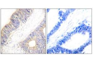 Immunohistochemistry (IHC) image for anti-Cystatin A (Stefin A) (CSTA) (Internal Region) antibody (ABIN1848778) (CSTA Antikörper  (Internal Region))