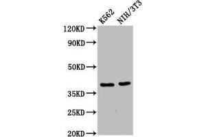 Western Blot Positive WB detected in: K562 whole cell lysate, NIH/3T3 whole cell lysate All lanes: ZNF367 antibody at 6 μg/mL Secondary Goat polyclonal to rabbit IgG at 1/50000 dilution Predicted band size: 39, 33 kDa Observed band size: 39 kDa (ZNF367 Antikörper  (AA 83-151))