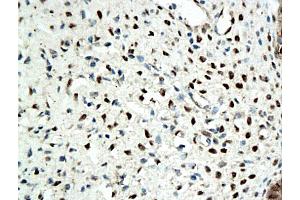 Formalin-fixed and paraffin embedded rat ovary tissue labeled with Anti-ER beta Polyclonal Antibody, Unconjugated (ABIN725210), followed by conjugation to the secondary antibody and DAB staining (ESR2 Antikörper  (AA 201-300))