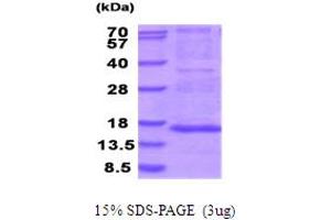 SDS-PAGE (SDS) image for Mitochondrial Ribosomal Protein S28 (MRPS28) (AA 72-187) protein (His tag) (ABIN5854040) (MRPS28 Protein (AA 72-187) (His tag))