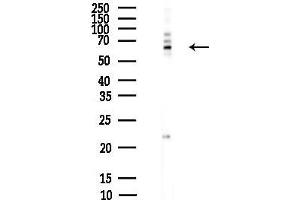 Western blot analysis of lysates from HepG2 cells(heat-shock,45 min treatment), using hnRNP Q Antibody at 1/1000 dilution.