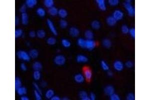 Immunofluorescence analysis of Human stomach tissue using Epsilon Tubulin Monoclonal Antibody at dilution of 1:200. (TUBE1 Antikörper)