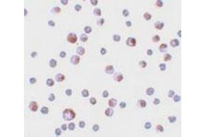 Immunocytochemical staining of HeLa cells with TCTN3 polyclonal antibody  at 4 ug/mL. (TCTN3 Antikörper  (C-Term))