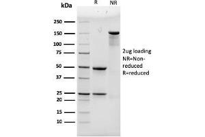 SDS-PAGE Analysis Purified ACTN4 Mouse Monoclonal Antibody (93). (alpha Actinin 4 Antikörper)