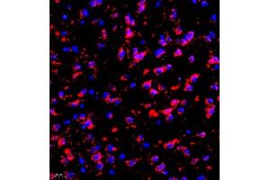 Immunofluorescence of paraffin embedded mouse brain using eIF5A2 (ABIN7073893) at dilution of 1:300 (400x lens) (EIF5A2 Antikörper)