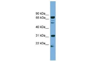 SLC6A3 antibody used at 0. (SLC6A3 Antikörper  (N-Term))
