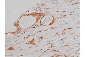 ABIN6267363 at 1/200 staining Human prostate tissue sections by IHC-P.