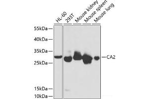 Western blot analysis of extracts of various cell lines using CA2 Polyclonal Antibody at dilution of 1:1000. (CA2 Antikörper)