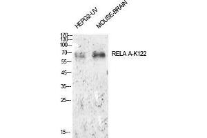 Western Blot (WB) analysis of HepG2-UV, Mouse Brain cells using Acetyl-NFkappaB-p65 (K122) Polyclonal Antibody. (NF-kB p65 Antikörper  (acLys122))