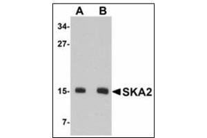 Western blot analysis of SKA2 in 3T3 cell lysate with SKA2 antibody at (A) 0. (FAM33A Antikörper  (N-Term))