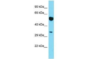 Western Blotting (WB) image for anti-Myosin XIX (MYO19) (N-Term) antibody (ABIN2790823) (Myosin XIX Antikörper  (N-Term))