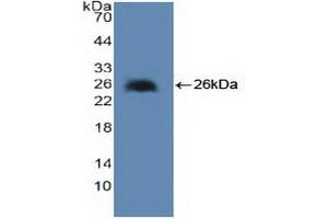 Detection of Recombinant cPLA2, Human using Polyclonal Antibody to Cytosolic Phospholipase A2 (PLA2G4) (PLA2G4A Antikörper  (AA 1-178))