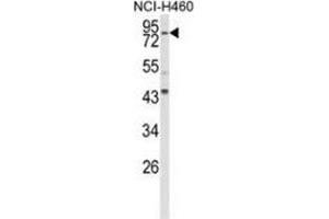 Western blot analysis of Spartin (arrow) in NCI-H460 cell line lysates (35ug/lane) using Spartin / SPG20  Antibody  (N-term).