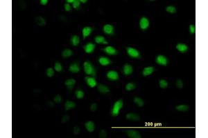 Image no. 3 for anti-Calcium Responsive Transcription Factor (CARF) (AA 621-719) antibody (ABIN599306) (Calcium Responsive Transcription Factor (CARF) (AA 621-719) Antikörper)