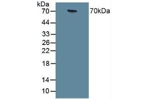 Detection of CHGA in Human Serum using Polyclonal Antibody to Chromogranin A (CHGA) (Chromogranin A Antikörper  (AA 15-148))