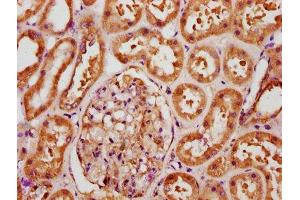 Immunohistochemistry (IHC) image for anti-Fibroblast Growth Factor 1 (Acidic) (FGF1) (AA 16-155) antibody (ABIN7152772)