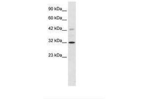 Image no. 2 for anti-Voltage-Dependent Anion Channel 1 (VDAC1) (C-Term) antibody (ABIN202157)