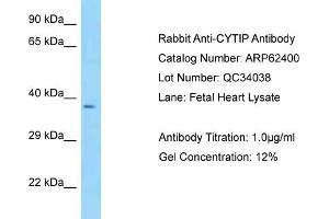 Western Blotting (WB) image for anti-Cytohesin 1 Interacting Protein (CYTIP) (N-Term) antibody (ABIN970496) (CYTIP Antikörper  (N-Term))