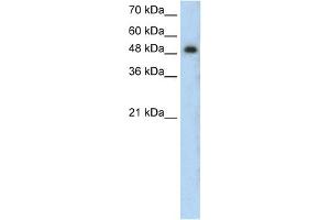 WB Suggested Anti-PRKCZ Antibody Titration:  0. (PKC zeta Antikörper  (N-Term))