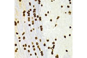 Immunohistochemistry of paraffin-embedded Rat brain using H3K27me2 antibody at dilution of 1:100 (x400 lens). (Histone 3 Antikörper  (H3K27me))