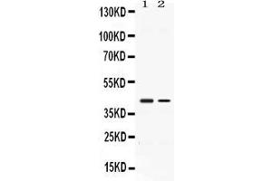 Western blot analysis of Abhd5 expression in rat kidney extract ( Lane 1) and A431 whole cell lysates ( Lane 2). (ABHD5 Antikörper  (AA 169-349))