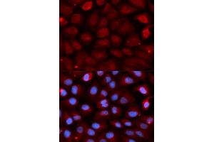 Immunofluorescence analysis of U2OS cells using FMR1 antibody.
