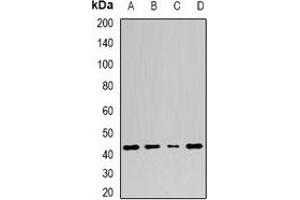 Western blot analysis of Adenosine Deaminase expression in A549 (A), Jurkat (B), mouse spleen (C), mouse stomach (D) whole cell lysates.