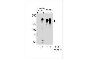 Western blot analysis of extracts from A431 cells,untreated or treated with EGF,100 ng/mL,using phospho ErbB2-(left) or ErbB2 Antibody (right) (ErbB2/Her2 Antikörper  (pTyr1221))