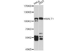 Western blot analysis of extracts of various cell lines, using MALT1 antibody. (MALT1 Antikörper)
