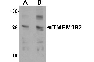 Western blot analysis of TMEM192 in SK-N-SH cell lysate with TMEM192 antibody at (A) 0. (TMEM192 Antikörper  (C-Term))