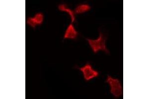 ABIN6269199 staining MCF7 by IF/ICC. (NFKBIA Antikörper  (C-Term))