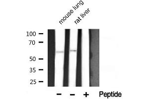 Western blot analysis of Akt1 phosphorylation expression in mouse lung and rat liver lysates,The lane on the right is treated with the antigen-specific peptide. (AKT1 Antikörper  (pThr450))