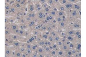 Detection of IL17RA in Mouse Liver Tissue using Polyclonal Antibody to Interleukin 17 Receptor A (IL17RA)
