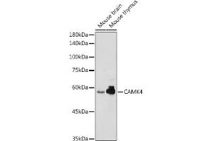 Western blot analysis of extracts of various cell lines, using C antibody (ABIN6130035, ABIN6137891, ABIN6137892 and ABIN6220925) at 1:1000 dilution. (CAMK4 Antikörper  (AA 304-473))