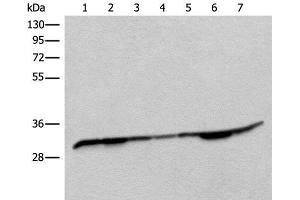 Western blot analysis of Rat heart tissue Mouse heart tissue Rat brain tissue Mouse brain tissue HEPG2 cell Jurkat and Lovo cell lysates using RSU1 Polyclonal Antibody at dilution of 1:400 (RSU1 Antikörper)