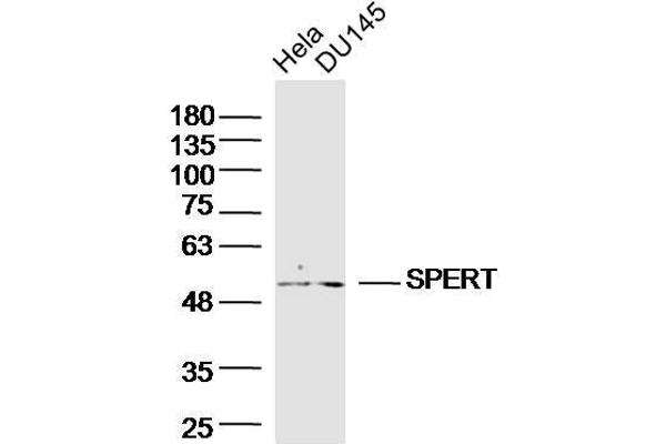 SPERT Antikörper  (AA 1-100)