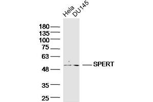 Lane 1: HeLa, Lane 2: DU145 cell lysates probed with SPERT Polyclonal Antibody  at 1:300 overnight at 4°C followed by a conjugated secondary antibody for 60 minutes at 37°C.