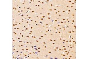 Immunohistochemistry of paraffin embedded mouse brain using DMRTA2 (ABIN7073753) at dilution of 1: 700 (400x lens) (DMRTA2 Antikörper)