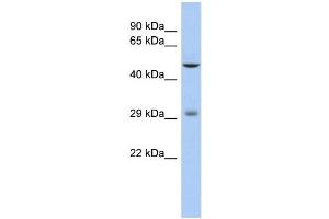 WB Suggested Anti-LBX1 Antibody Titration: 0. (Lbx1 Antikörper  (Middle Region))