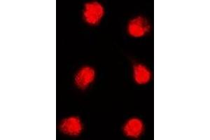 Immunofluorescent analysis of APTX staining in K562 cells. (Aprataxin Antikörper)