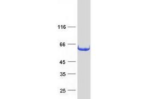 Western Blotting (WB) image for Interferon-Induced Protein with Tetratricopeptide Repeats 3 (IFIT3) (Transcript Variant 2) protein (Myc-DYKDDDDK Tag) (ABIN2723306)