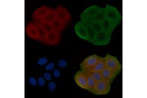 ABIN6258835 and ABIN6275157 staining Hela cells(30 min of UV treatment) by IF/ICC. (GORASP2 Antikörper  (Internal Region))